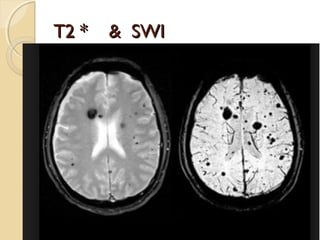 T2 * & SWIT2 * & SWI
 