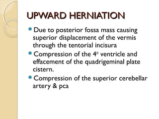 UPWARD HERNIATIONUPWARD HERNIATION
Due to posterior fossa mass causing
superior displacement of the vermis
through the tentorial incisura
Compression of the 4th
ventricle and
effacement of the quadrigeminal plate
cistern.
Compression of the superior cerebellar
artery & pca
 