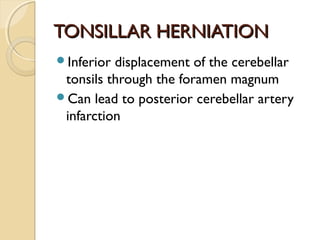 TONSILLAR HERNIATIONTONSILLAR HERNIATION
Inferior displacement of the cerebellar
tonsils through the foramen magnum
Can lead to posterior cerebellar artery
infarction
 
