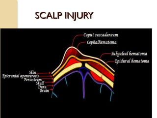 SCALP INJURYSCALP INJURY
 