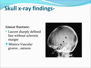 Skull x-ray findings-
Linear fracture-
• Lucent sharply defined
line without sclerotic
margin
Mimics-Vascular
groove , sutures
 