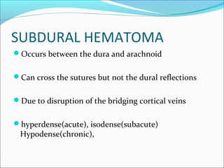 SUBDURAL HEMATOMA
Occurs between the dura and arachnoid
Can cross the sutures but not the dural reflections
Due to disruption of the bridging cortical veins
hyperdense(acute), isodense(subacute)
Hypodense(chronic),
 