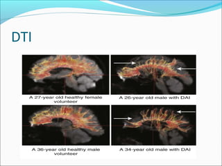 DTI
 