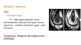 Imaging in infections of bones and joints2.pptx