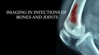 IMAGING IN INFECTIONS OF
BONES AND JOINTS
 