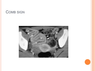 Imaging in Inflammatory Bowel Disease | PPTX