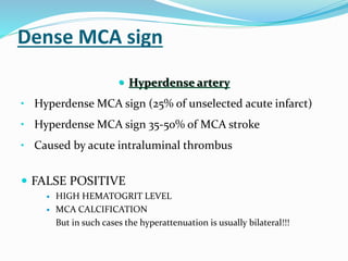  Hyperdense artery
• Hyperdense MCA sign (25% of unselected acute infarct)
• Hyperdense MCA sign 35-50% of MCA stroke
• Caused by acute intraluminal thrombus
 FALSE POSITIVE
 HIGH HEMATOGRIT LEVEL
 MCA CALCIFICATION
But in such cases the hyperattenuation is usually bilateral!!!
Dense MCA sign
 