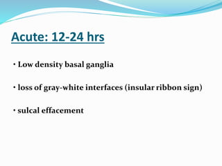 Acute: 12-24 hrs
• Low density basal ganglia
• loss of gray-white interfaces (insular ribbon sign)
• sulcal effacement
 