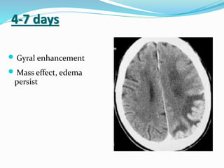 4-7 days
 Gyral enhancement
 Mass effect, edema
persist
 