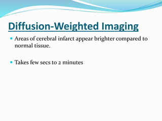 Diffusion-Weighted Imaging
 Areas of cerebral infarct appear brighter compared to
normal tissue.
 Takes few secs to 2 minutes
 