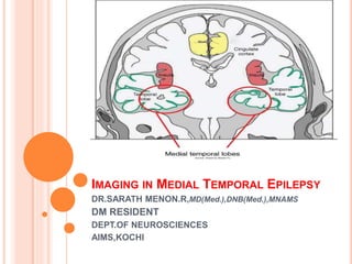 IMAGING IN MEDIAL TEMPORAL EPILEPSY
DR.SARATH MENON.R,MD(Med.),DNB(Med.),MNAMS
DM RESIDENT
DEPT.OF NEUROSCIENCES
AIMS,KOCHI
 