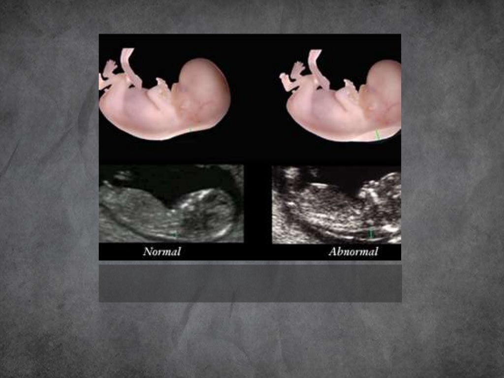 Imaging in obstetrics & gynaecology