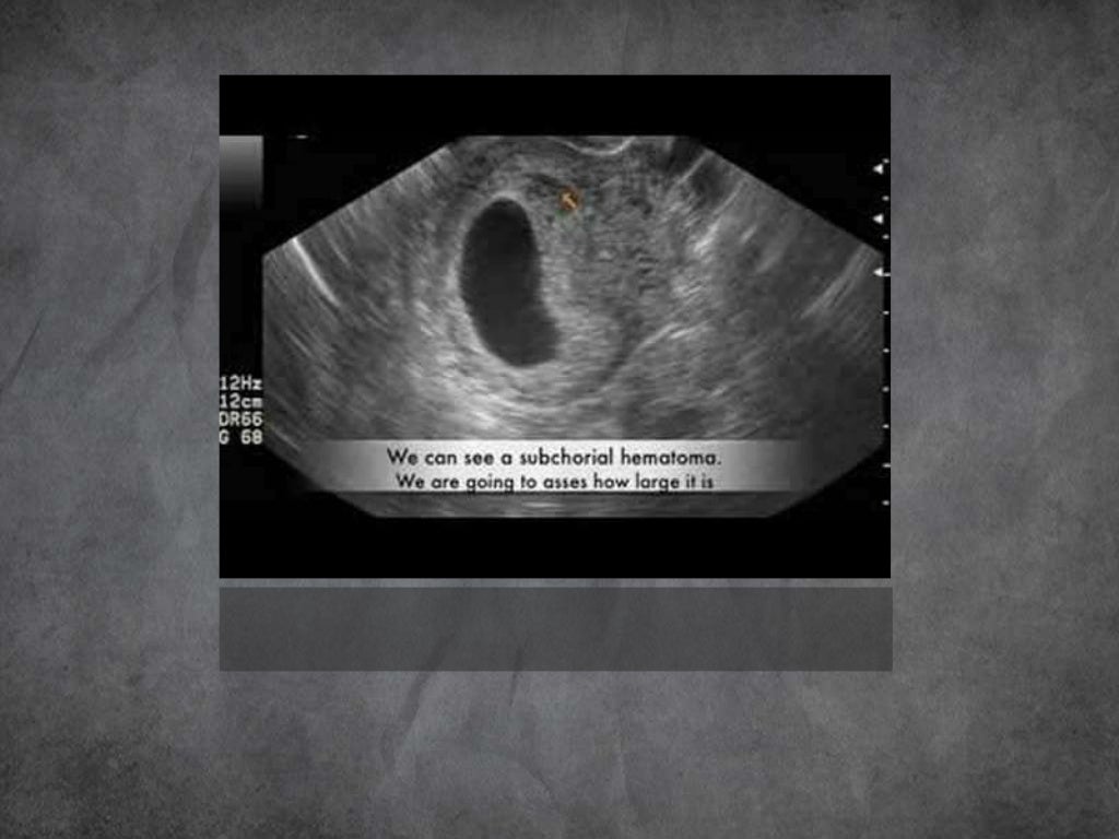 Imaging in obstetrics & gynaecology