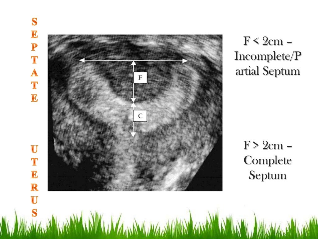 Imaging in obstetrics & gynaecology (part 1 Gynaecological scans in
