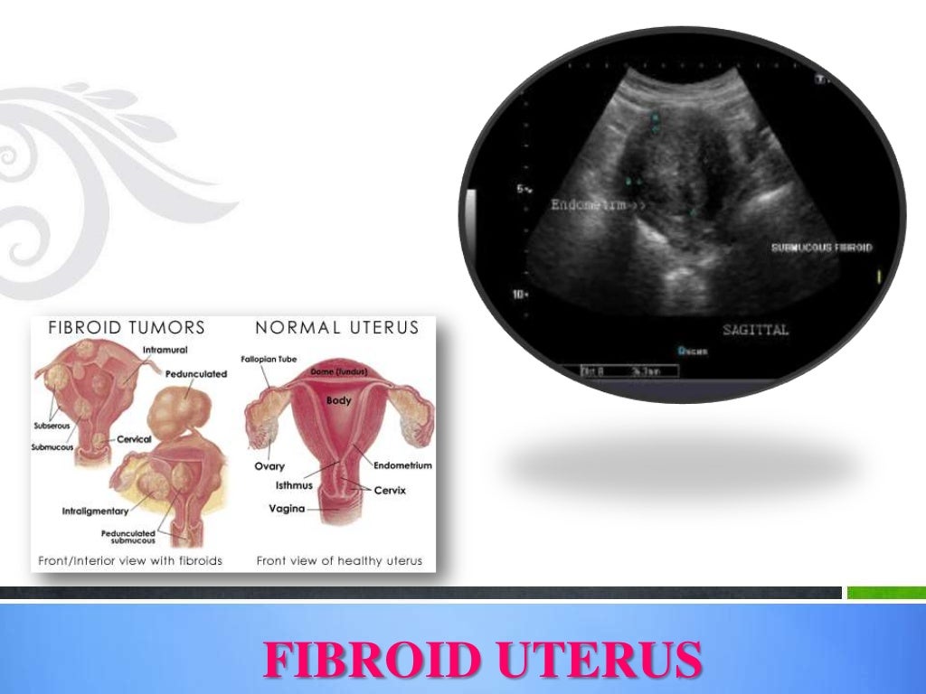 Imaging in obstetrics & gynaecology (part 1 Gynaecological scans in