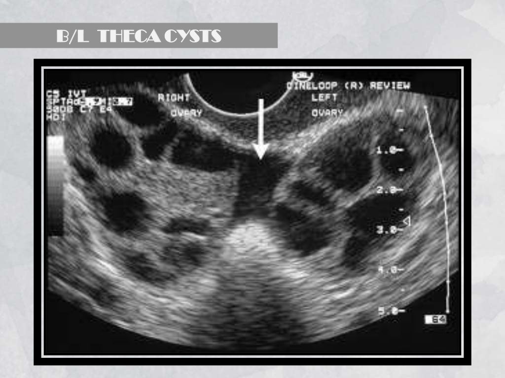 Imaging in obstetrics & gynaecology (part 1 Gynaecological scans in