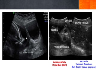 Imaging in obstetrics & gynaecology part 2 | PPTX
