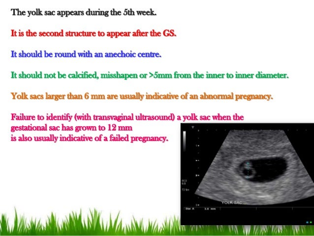 dating scan crl Calculates gestational age from crown rump length and expected nuchal translucency thickness. dating scan crl Calculates gestational age from crown rump length and expected nuchal translucency thickness.