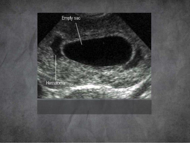 Imaging in obstetrics & gynaecology part 2