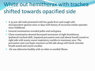 White out hemithorax with trachea
shifted towards opacified side
 A 35 year old male presented with low grade fever and cough with
mucopurulent sputum since 10 days with history of recurrent similar episodes
since childhood.
 General examination revealed pallor and tachypnea.
 Chest examination showed decreased movement of right hemithorax,
ipsilateral tracheal shift, impaired percussion note and absent breath sound on
right side with scanty coarse inspiratory crackles in mammary area. The
percussion note was hyper resonant on left side along with harsh vesicular
breath sound and coarse crackles.
 He was otherwise healthy with no other co morbid illness.
 