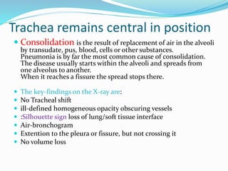 Trachea remains central in position
 Consolidation is the result of replacement of air in the alveoli
by transudate, pus, blood, cells or other substances.
Pneumonia is by far the most common cause of consolidation.
The disease usually starts within the alveoli and spreads from
one alveolus to another.
When it reaches a fissure the spread stops there.
 The key-findings on the X-ray are:
 No Tracheal shift
 ill-defined homogeneous opacity obscuring vessels
 :Silhouette sign loss of lung/soft tissue interface
 Air-bronchogram
 Extention to the pleura or fissure, but not crossing it
 No volume loss
 