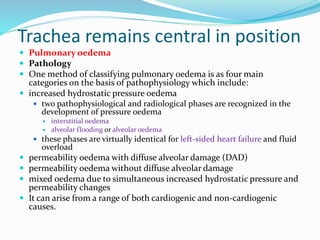 Trachea remains central in position
 Pulmonary oedema
 Pathology
 One method of classifying pulmonary oedema is as four main
categories on the basis of pathophysiology which include:
 increased hydrostatic pressure oedema
 two pathophysiological and radiological phases are recognized in the
development of pressure oedema
 interstitial oedema
 alveolar flooding or alveolar oedema
 these phases are virtually identical for left-sided heart failure and fluid
overload
 permeability oedema with diffuse alveolar damage (DAD)
 permeability oedema without diffuse alveolar damage
 mixed oedema due to simultaneous increased hydrostatic pressure and
permeability changes
 It can arise from a range of both cardiogenic and non-cardiogenic
causes.
 