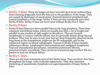  Kerley A lines-These are longer (at least 2cm and up to 6cm) unbranching
lines coursing diagonally from the hila out to the periphery of the lungs. They
are caused by distension of anastomotic channels between peripheral and
central lymphatics of the lungs. Kerley A lines are less commonly seen than
Kerley B lines. Kerley A lines are never seen without Kerley B or C lines .
 Kerley B lines
 Kerley B linesThese are short parallel lines at the lung periphery. These lines
represent interlobular septa, which are usually less than 1 cm in length and
parallel to one another at right angles to the pleura. They are located
peripherally in contact with the pleura, but are generally absent along fissural
surfaces. They may be seen in any zone but are most frequently observed at the
lung bases at the costophrenic angles on the PA radiograph, and in the
substernal region on lateral radiographs. [Causes of Kerley B lines include;
pulmonary edema, lymphangitis carcinomatosa and malignant lymphoma,
viral and mycoplasmal pneumonia, interstitial pulmonary fibrosis,
pneumoconiosis, sarcoidosis. They can be an evanescent sign on the CXR of a
patient in and out of heart failure.
 Kerley C lines
 These are the least commonly seen of the Kerley lines. They are short, fine lines
throughout the lungs, with a reticular appearance. They may represent
thickening of anastomotic lymphatics or superimposition of many Kerley B
lines.
 