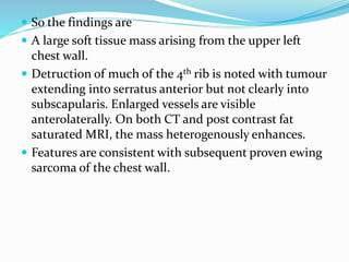 So the findings are
 A large soft tissue mass arising from the upper left
chest wall.
 Detruction of much of the 4th rib is noted with tumour
extending into serratus anterior but not clearly into
subscapularis. Enlarged vessels are visible
anterolaterally. On both CT and post contrast fat
saturated MRI, the mass heterogenously enhances.
 Features are consistent with subsequent proven ewing
sarcoma of the chest wall.
 