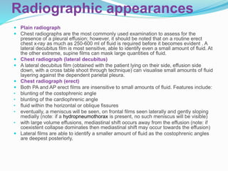 Radiographic appearances
 Plain radiograph
 Chest radiographs are the most commonly used examination to assess for the
presence of a pleural effusion; however, it should be noted that on a routine erect
chest x-ray as much as 250-600 ml of fluid is required before it becomes evident . A
lateral decubitus film is most sensitive, able to identify even a small amount of fluid. At
the other extreme, supine films can mask large quantities of fluid.
 Chest radiograph (lateral decubitus)
 A lateral decubitus film (obtained with the patient lying on their side, effusion side
down, with a cross table shoot through technique) can visualise small amounts of fluid
layering against the dependent parietal pleura.
 Chest radiograph (erect)
 Both PA and AP erect films are insensitive to small amounts of fluid. Features include:
• blunting of the costophrenic angle
• blunting of the cardiophrenic angle
• fluid within the horizontal or oblique fissures
• eventually, a meniscus will be seen, on frontal films seen laterally and gently sloping
medially (note: if a hydropneumothorax is present, no such meniscus will be visible)
• with large volume effusions, mediastinal shift occurs away from the effusion (note: if
coexistent collapse dominates then mediastinal shift may occur towards the effusion)
 Lateral films are able to identify a smaller amount of fluid as the costophrenic angles
are deepest posteriorly.
 