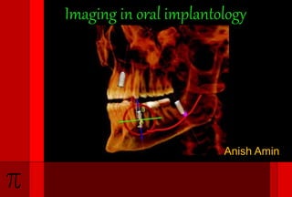 Imaging in oral implantology
Anish Amin
 