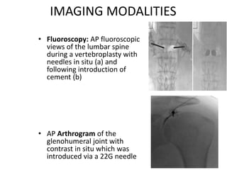 Imaging in orthopaedics | PPTX
