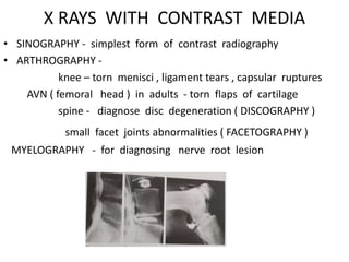 X RAYS WITH CONTRAST MEDIA
• SINOGRAPHY - simplest form of contrast radiography
• ARTHROGRAPHY -
knee – torn menisci , ligament tears , capsular ruptures
AVN ( femoral head ) in adults - torn flaps of cartilage
spine - diagnose disc degeneration ( DISCOGRAPHY )
small facet joints abnormalities ( FACETOGRAPHY )
MYELOGRAPHY - for diagnosing nerve root lesion
 