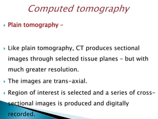  Plain tomography –
 Like plain tomography, CT produces sectional
images through selected tissue planes – but with
much greater resolution.
 The images are trans-axial.
 Region of interest is selected and a series of cross-
sectional images is produced and digitally
recorded.
 