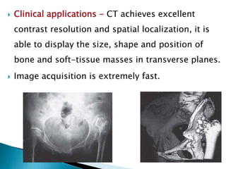 Clinical applications - CT achieves excellent
contrast resolution and spatial localization, it is
able to display the size, shape and position of
bone and soft-tissue masses in transverse planes.
 Image acquisition is extremely fast.
 