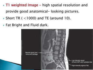  T1 weighted Image - high spatial resolution and
provide good anatomical- looking pictures.
 Short TR ( <1000) and TE (around 10).
 Fat Bright and Fluid dark.
 