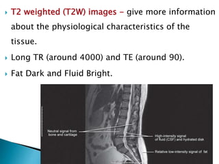  T2 weighted (T2W) images - give more information
about the physiological characteristics of the
tissue.
 Long TR (around 4000) and TE (around 90).
 Fat Dark and Fluid Bright.
 