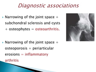  Narrowing of the joint space +
subchondral sclerosis and cysts
+ osteophytes = osteoarthritis.
 Narrowing of the joint space +
osteoporosis + periarticular
erosions = inflammatory
arthritis
 