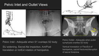 IMAGING IN ORTHOPAEDIC SURGERY - AN OVERVIEW | PPTX