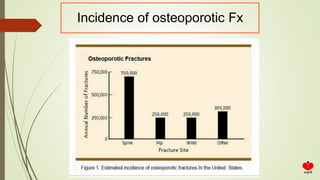 Incidence of osteoporotic Fx
 