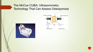 The McCue CUBA: Ultrasonometry
Technology That Can Assess Osteoporosis
 
