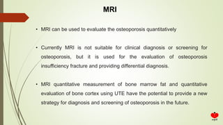 MRI
• MRI can be used to evaluate the osteoporosis quantitatively
• Currently MRI is not suitable for clinical diagnosis or screening for
osteoporosis, but it is used for the evaluation of osteoporosis
insufficiency fracture and providing differential diagnosis.
• MRI quantitative measurement of bone marrow fat and quantitative
evaluation of bone cortex using UTE have the potential to provide a new
strategy for diagnosis and screening of osteoporosis in the future.
 