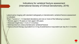 Indications for vertebral fracture assessment
(International Society of Clinical Densitometry, 2019)
Lateral spine imaging with standard radiography or densitometric vertebral fracture assessment
is indicated:
When T-score is < -1.0 standard deviations and one or more of the following is present.
• Women aged ≥ 70 years or men aged ≥ 80 years
• Historical height loss > 4 cm (>1.5 inches)
• Self-reported but undocumented prior vertebral fracture
• Glucocorticoid therapy equivalent to ≥ 5 mg of prednisone or equivalent per day for ≥ 3 months
 