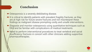 Conclusion
 Osteoporosis is a severely debilitating disease.
 It is critical to identify patients with prevalent fragility fractures, as they
are at high risk for future severe fractures and not misinterpret these
findings as malignant disease prompting costly and unsafe interventions.
 Diagnose and monitor osteoporosis using quantitative techniques such as
DXA and be familiar with complications of medical treatments.
 Need to perform interventional procedures to treat vertebral and sacral
insufficiency fractures in concert with other clinicians adding supportive
pharmacotherapies.
Link TM. Radiology of osteoporosis. Canadian Association of Radiologists' Journal. 2016 Feb;67(1):28-40
 