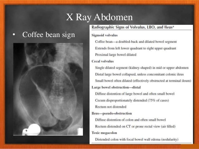 Imaging in pain abdomen