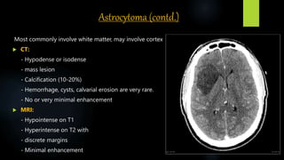 Astrocytoma (contd.)
Most commonly involve white matter, may involve cortex
 CT:
- Hypodense or isodense
- mass lesion
- Calcification (10‐20%)
- Hemorrhage, cysts, calvarial erosion are very rare.
- No or very minimal enhancement
 MRI:
- Hypointense on T1
- Hyperintense on T2 with
- discrete margins
- Minimal enhancement
 