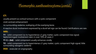 Pleomorphic xanthoastrocytoma (contd.)
CT:
usually present as cortical tumours with a cystic component
vivid contrast enhancement
no surrounding oedema; scalloping of the overlying bone.
A reactive dural involvement expressed by a dural tail sign can be found; Calcifications are rare.
MRI:
T1 - solid component iso to hypointense c.f. grey matter; cystic component low signal;
leptomeningeal involvement seen in over 70% of cases 2
T1 C+​ (Gd) - solid component usually enhances vividly
T2 - solid component iso to hyperintense c.f. grey matter; cystic component high signal; little
surrounding vasogenic oedema
DSA - avascular on angiography
 