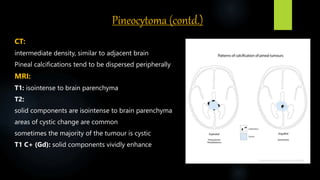 Pineocytoma (contd.)
CT:
intermediate density, similar to adjacent brain
Pineal calcifications tend to be dispersed peripherally
MRI:
T1: isointense to brain parenchyma
T2:
solid components are isointense to brain parenchyma
areas of cystic change are common
sometimes the majority of the tumour is cystic
T1 C+ (Gd): solid components vividly enhance
 