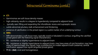 Intracranial Germinoma (contd.)
 CT:
 Germinomas are soft tissue density masses
 high cellularity results in a degree to hyperdensity compared to adjacent brain
 typically seen filling and expanding the infundibular recess and supraoptic recess
 subtle abnormal pituitary stalk enhancement and thickening
 presence of calcification in the pineal region is a useful marker of an underlying tumour
 MRI:
 MRI demonstrates a soft tissue mass, typically ovoid or lobulated in contour, engulfing the calcified
pineal gland with the following signal characteristics
 T1 - isointense or slightly hyperintense to adjacent brain
 T2 - isointense or slightly hyperintense to adjacent brain; may have areas of cyst formation; may have
areas of haemorrhage (low signal); have a predilection to invade adjacent brain (oedema); central
calcification appears low signal (engulfed pineal gland)
 T1 C+ (Gd): vivid and homogeneous
 