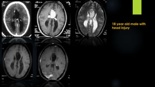18 year old male with
head injury
 