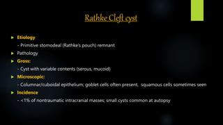 Rathke Cleft cyst
 Etiology
- Primitive stomodeal (Rathke’s pouch) remnant
 Pathology
 Gross:
- Cyst with variable contents (serous, mucoid)
 Microscopic:
- Columnar/cuboidal epithelium; goblet cells often present, squamous cells sometimes seen
 Incidence
- <1% of nontraumatic intracranial masses; small cysts common at autopsy
 